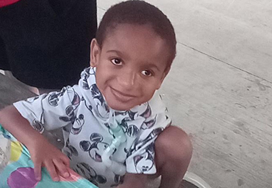 Dominic, a young dark-skinned boy with a tracheostomy, looks up and smiles while sitting on a bench