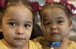 Twin toddlers Olivia and Ava Vasquez look at the camera. Ava is medically complex and has a tracheostomy tube.